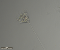 Vorticella