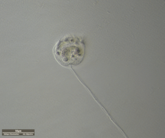 Vorticella