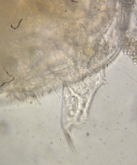 Chydorus sphaericus