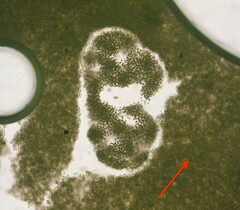 Microcystis