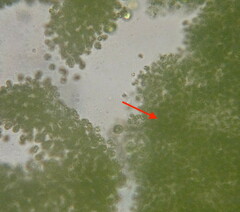 Microcystis
