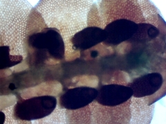 Frullania teneriffae