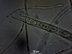 Sarcoscypha coccinea