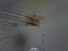 Sarcoscypha coccinea