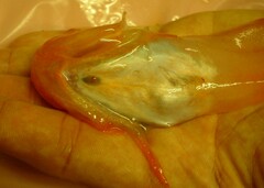 Careproctus mederi