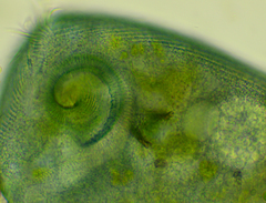 Stentor coeruleus