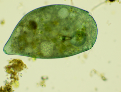 Stentor coeruleus