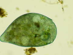 Stentor coeruleus