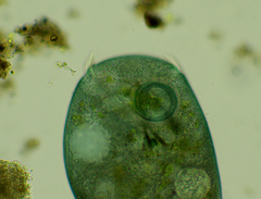 Stentor coeruleus