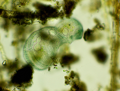 Stentor coeruleus
