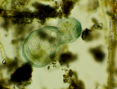 Stentor coeruleus