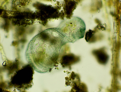 Stentor coeruleus