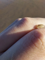 Eumalacostraca