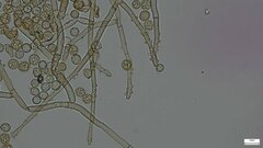 Botryobasidium