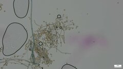 Botryobasidium