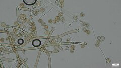 Botryobasidium