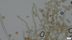 Botryobasidium