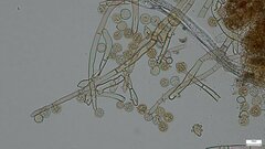 Botryobasidium