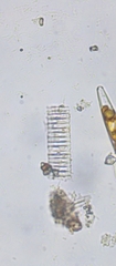 Fragilaria