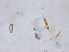 Fragilaria