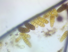 Berkleasmium concinnum