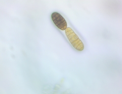 Berkleasmium concinnum