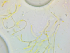 Dacrymyces minor