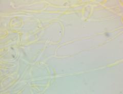 Dacrymyces minor