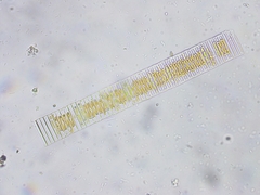 Fragilaria