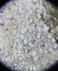 Lecanora nothocaesiella