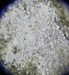 Lecanora nothocaesiella