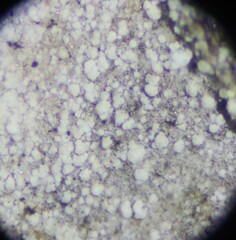 Lecanora nothocaesiella