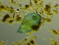 Stentor coeruleus