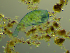 Stentor coeruleus