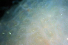 Polycitoridae