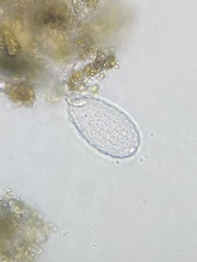 Euglyphidae