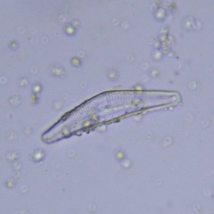 Cymbella