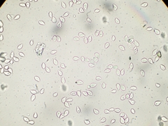 Cylindrobasidium evolvens
