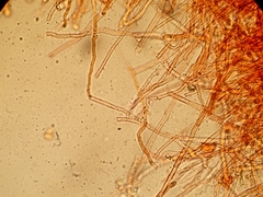 Cylindrobasidium evolvens