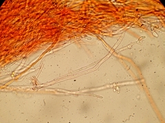 Cylindrobasidium evolvens