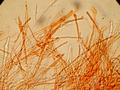 Cylindrobasidium evolvens