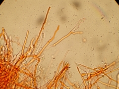 Cylindrobasidium evolvens