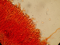 Cylindrobasidium evolvens