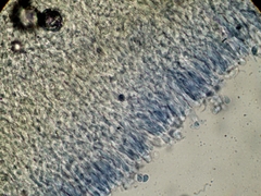 Cylindrobasidium evolvens