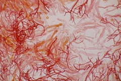 Scytinostroma hemidichophyticum