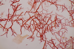 Scytinostroma hemidichophyticum