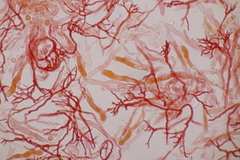 Scytinostroma hemidichophyticum