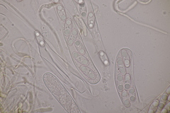 Octospora musci-muralis