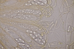 Octospora musci-muralis