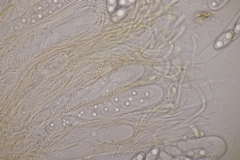 Octospora musci-muralis